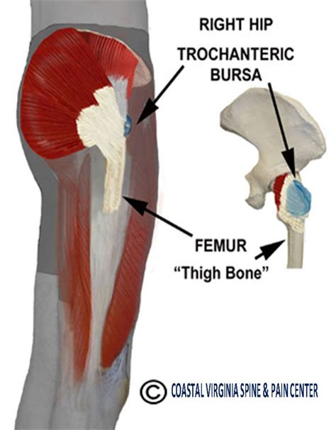 how to pronounce trochanteric bursitis.